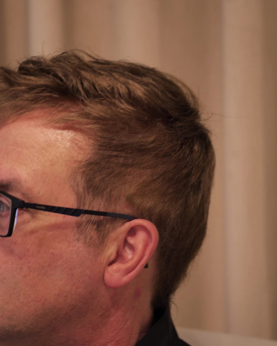 The same client in profile after his non-surgical hair system was fitted, cut and styled at Studio Beige